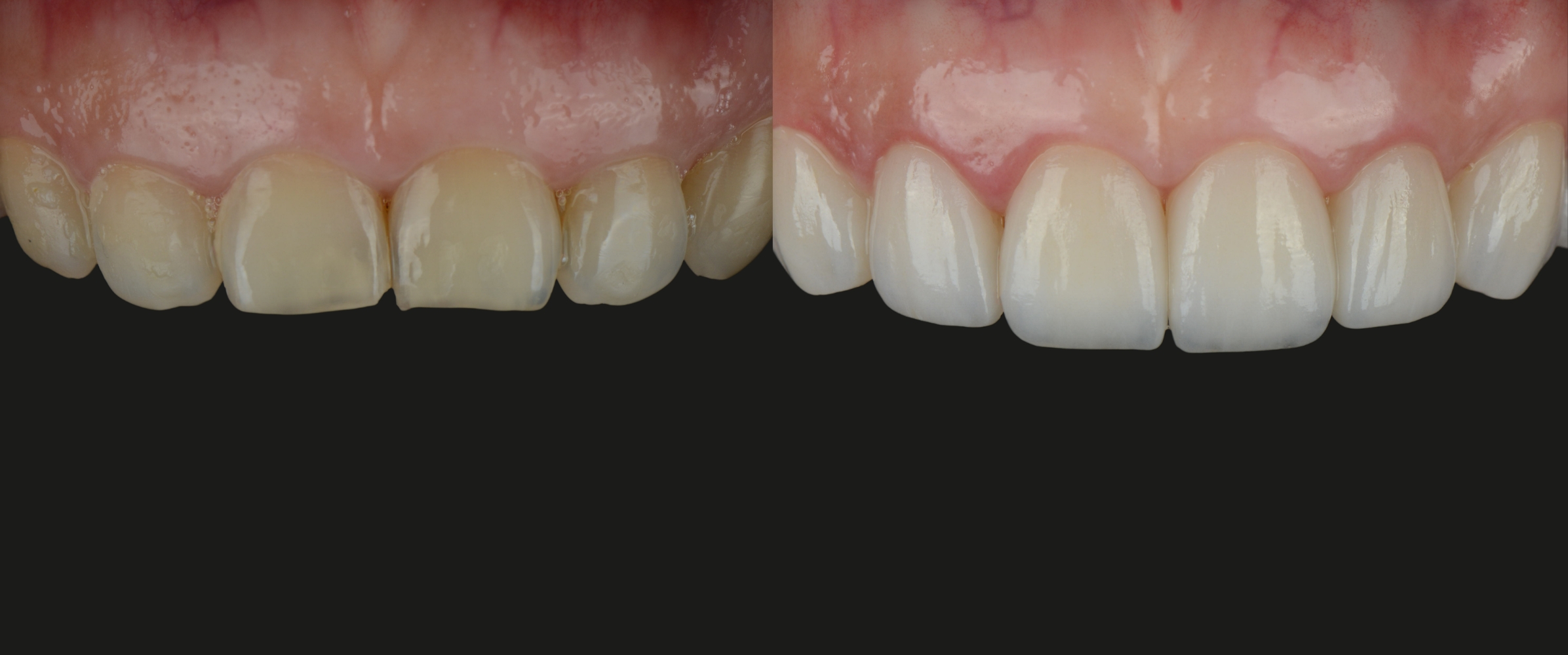 Envy Dental